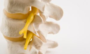how to support a loved one through spinal surgery